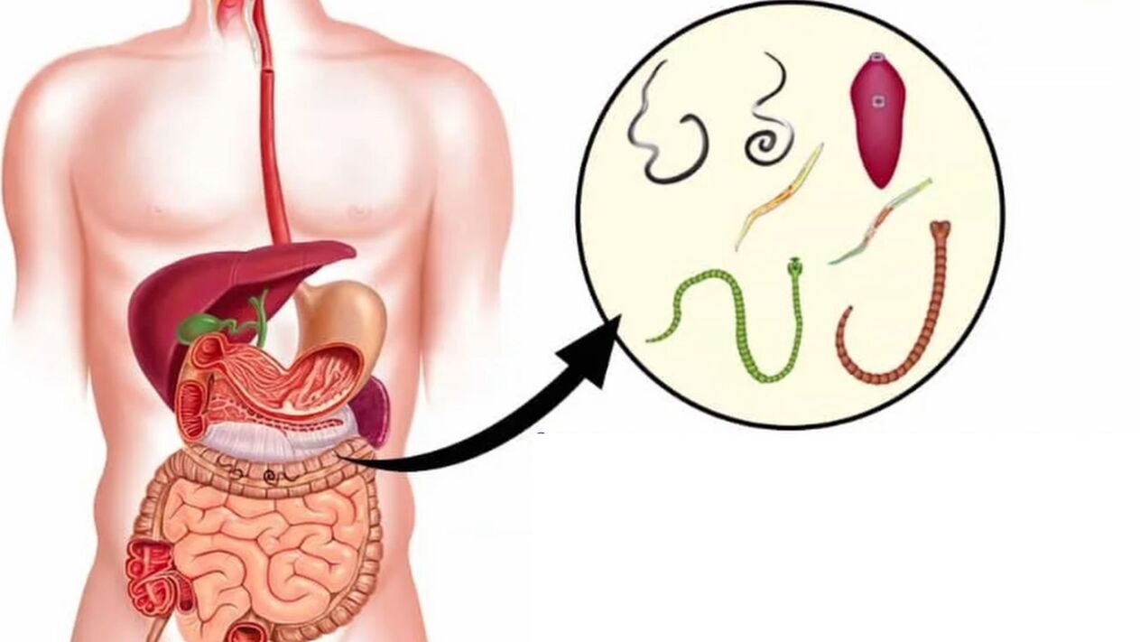 Types de parasites dans le corps