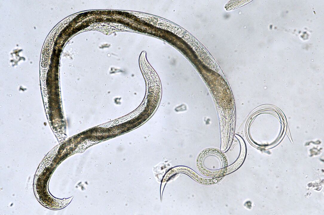 Types de parasites pouvant coloniser le corps