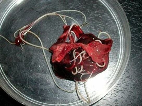 Vers du corps humain